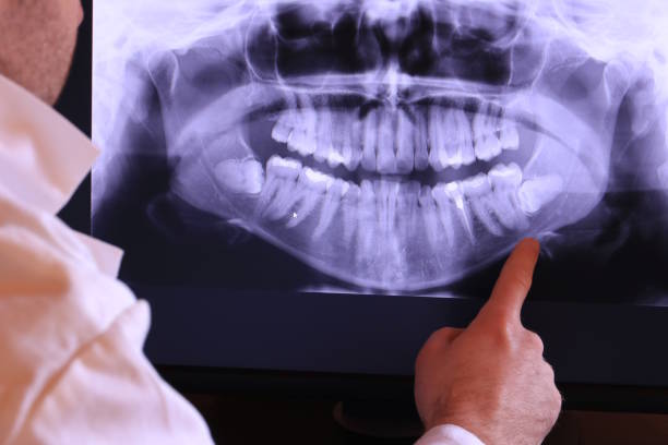 Best Holiday Emergency Dentist in Canyon, TX